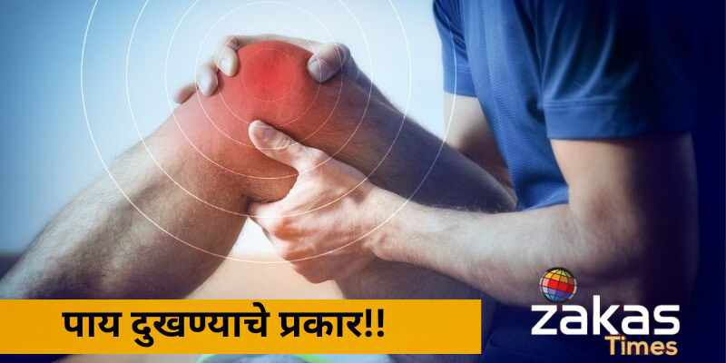 Leg Pain ( पाय दुखणे )