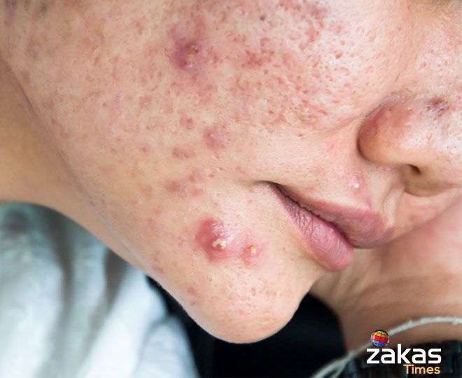 लिव्हर खराब होण्याची लक्षणे